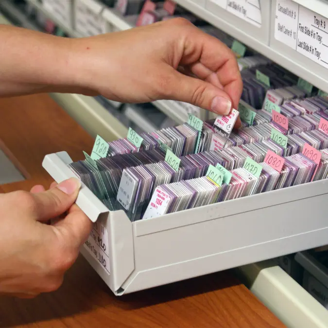 Blood Slide Pathology Vertical Carousel